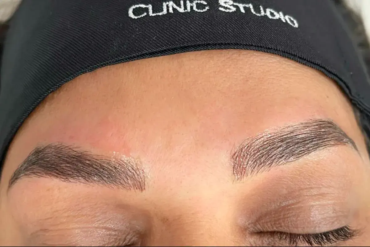 Micropigmentação - 2